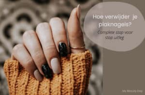 Hoe verwijder je plaknagels?