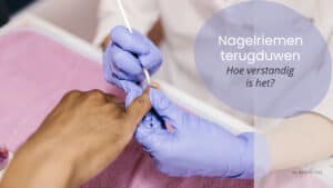 Is het terugduwen van je nagelriemen verstandig