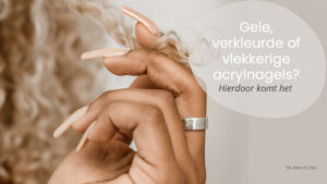 Gele, verkleurde of vlekkerige acrylnagels