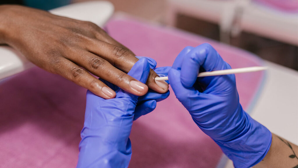 Nagelriemen terugduwen met bokkenpootje