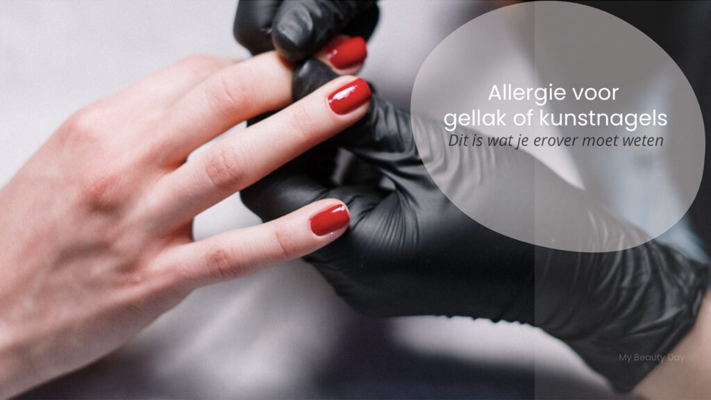 allergie voor gellak of kunstnagels