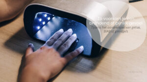 branderig-of-pijnlijk-gevoel-bij-aanbrengen-van-gel