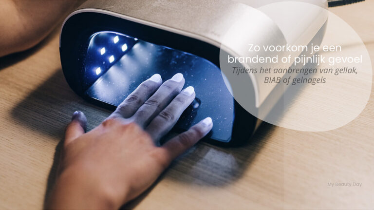 branderig-of-pijnlijk-gevoel-bij-aanbrengen-van-gel