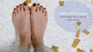 gellak-op-kalknagels