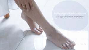 kalknagels behandelen
