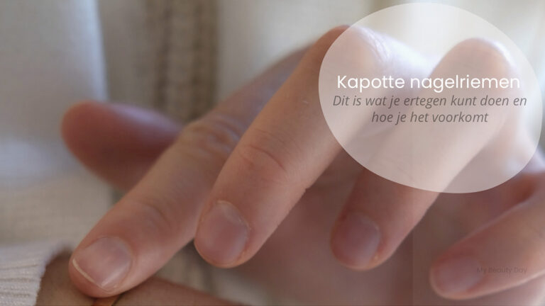 kapotte of droge nagelriemen